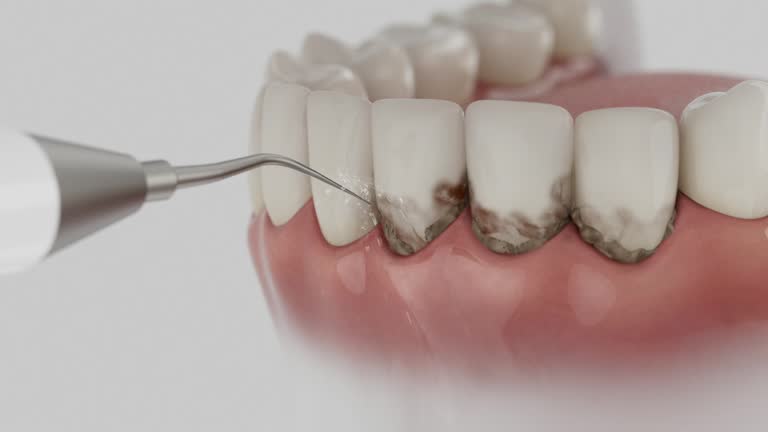 Trusted Teeth Whitening service in Montecito, CA - Dentist Open Now